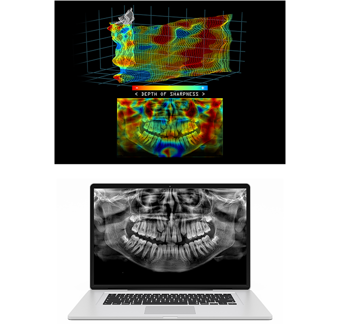 feature-image-1